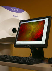 Optomap Ultra-Wide Retinal Imaging now available! - Sparks & Feros Optometrists